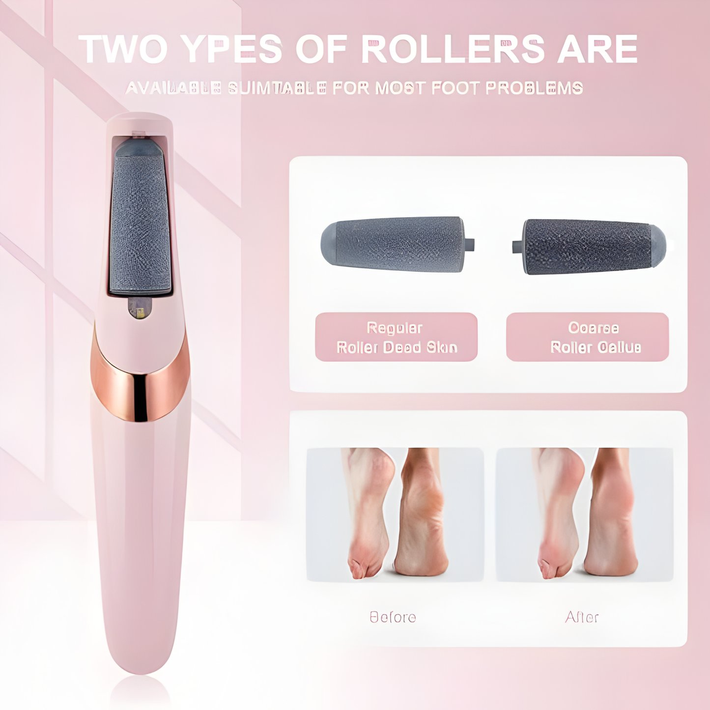 USB Rechargeable Foot Callus Remover – Electric File with LED Light & 2-Speed Settings for Smooth Feet